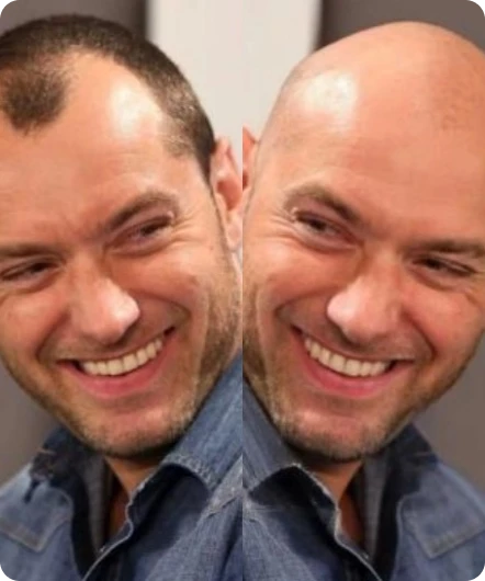 Bald Filter Image Generator