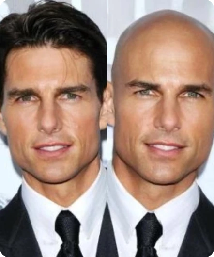 Bald Filter Image Generator