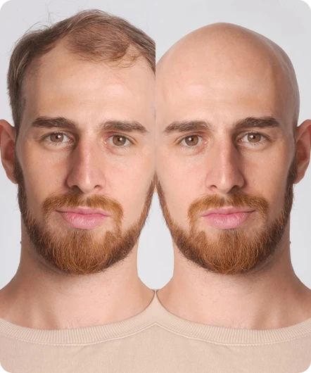 Bald Filter Image Generator