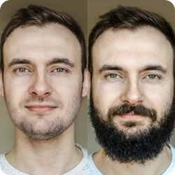 Add Beard Image Generator