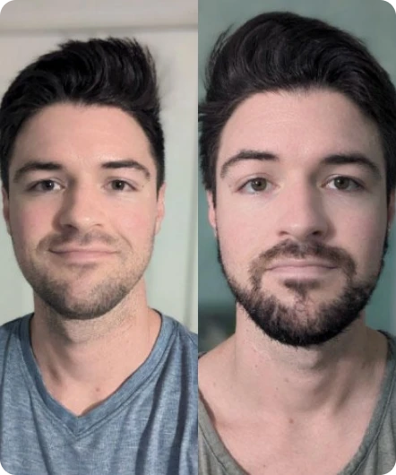 Add Beard Image Generator