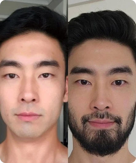 Add Beard Image Generator