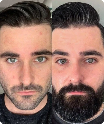 Add Beard Image Generator